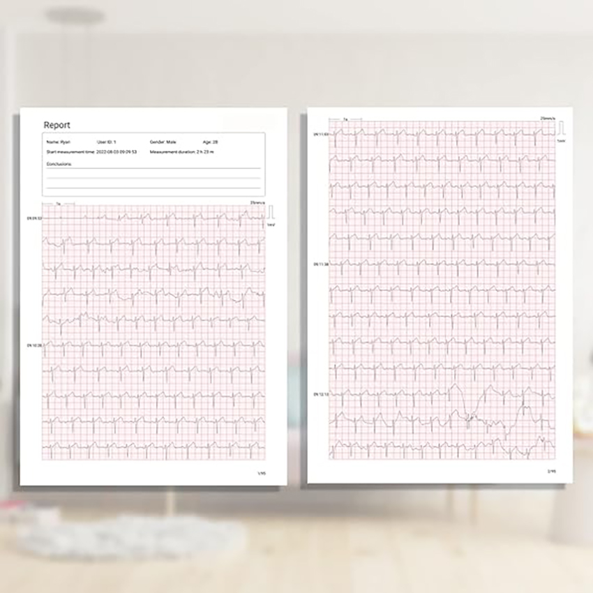 【輪椅王】 將顯示兩頁列印頁面，其中包含心電圖 (ECG) 報告，左側為患者詳細信息，右側為心電圖描記圖。背景描繪了柔和聚焦的室內環境，並透過 24 小時胸導聯裝置（附免費 AI 分析和 PC 報告）的數據進行了增強。