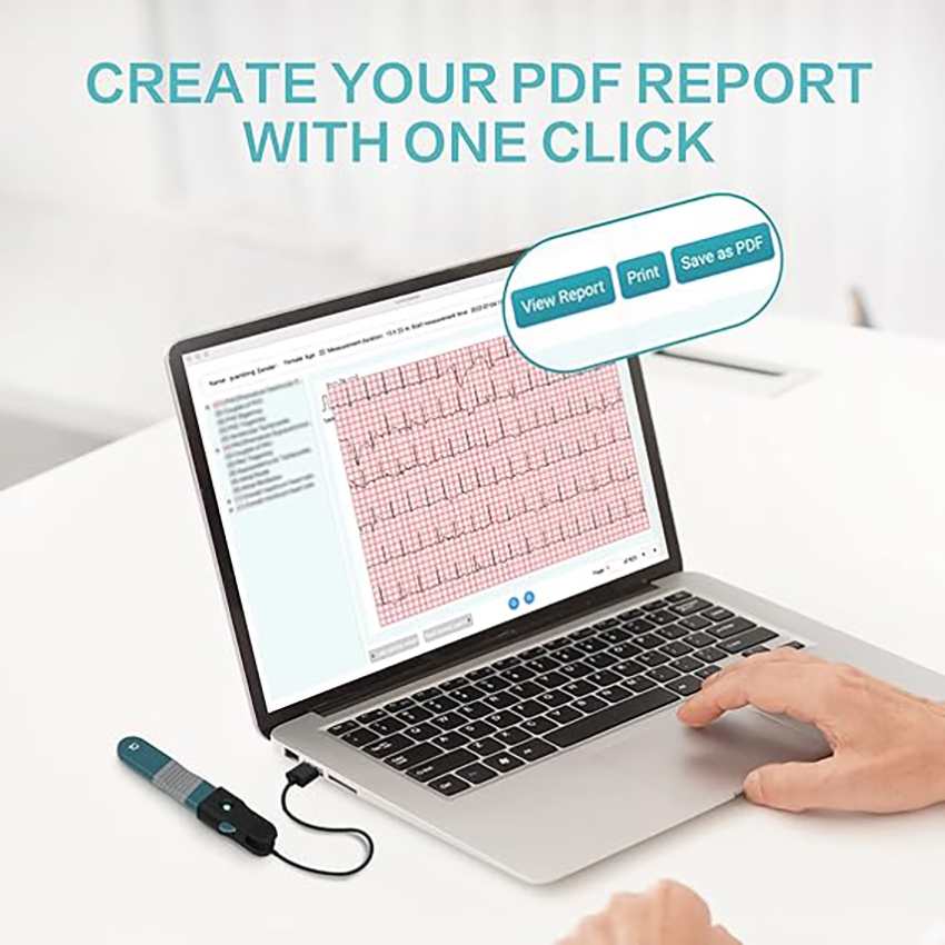 【輪椅王】 筆記型電腦螢幕顯示 PDF 報告介面，其中包含檢視、列印或儲存選項。一隻手使用連接的設備來產生報告。螢幕上方的文字為「一鍵建立您的 PDF 報告」。該裝置包括一個 24 小時胸導聯裝置（附有免費的人工智慧分析和電腦報告）。