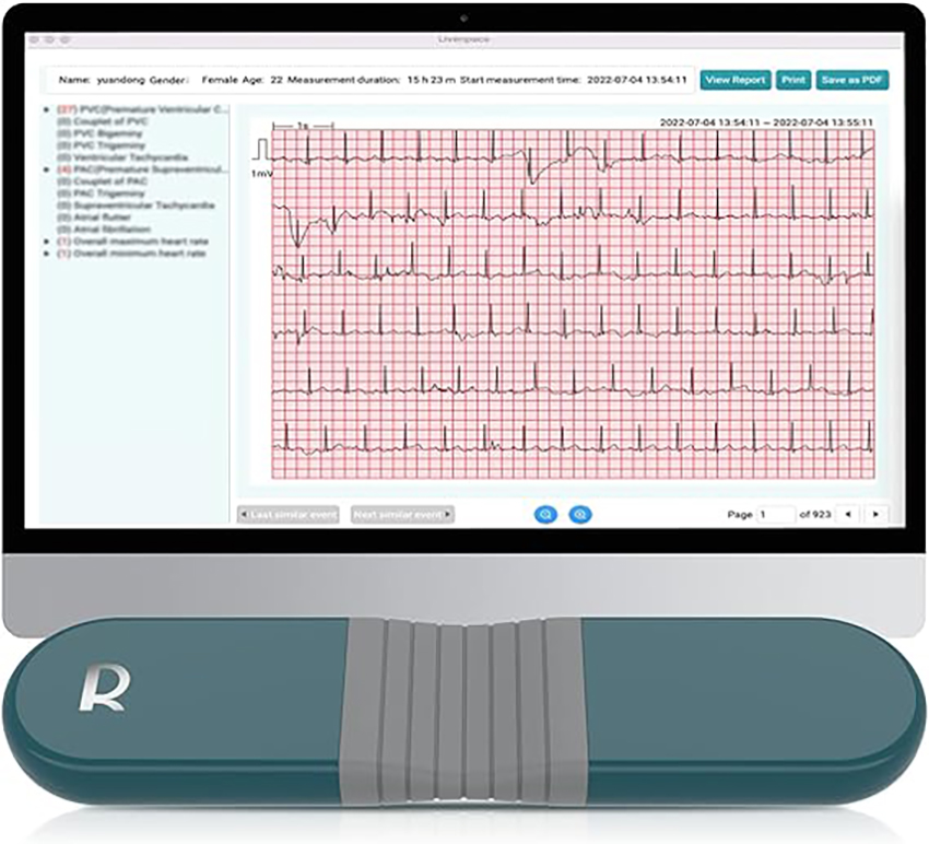 【輪椅王】 電腦螢幕顯示詳細的心電圖以及病患資訊。螢幕前面是一個青色的便攜式心電圖設備，上面有字母“R”，它也可以用作 24 小時胸導聯裝置（附免費 AI 分析和 PC 報告）。