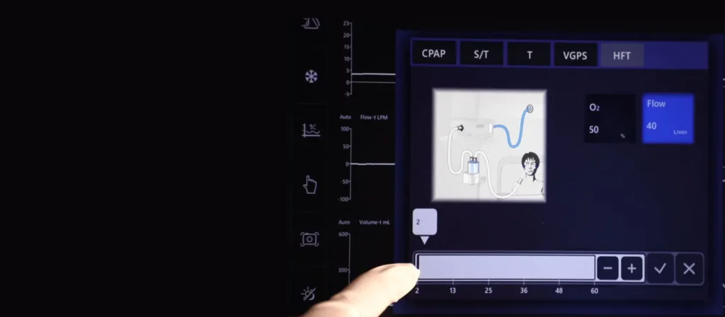 【輪椅王】 手指指向醫療設備螢幕，顯示重症監護呼吸器 VG55 的設置，顯示 CPAP、S/T、T 和 HFT 選項。旁邊有一張圖表，展示了患者連接到機器的情況。